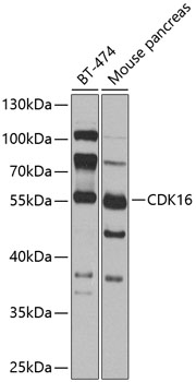 CDK16 Polyclonal Antibody