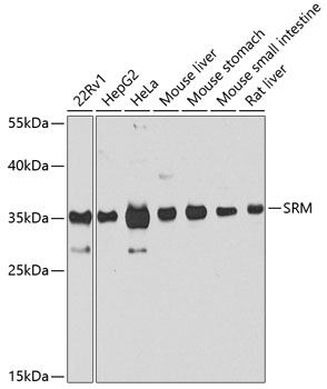 SRM Polyclonal Antibody