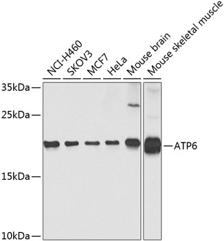 ATP6 Polyclonal Antibody