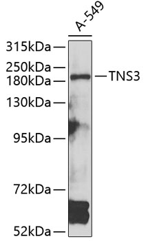 TNS3 Polyclonal Antibody