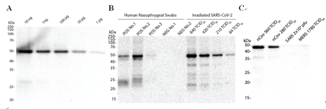 Anti-Nucleocapsid (N) Rabbit Monoclonal Antibody