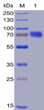Human CD28 Protein, mFc-His Tag