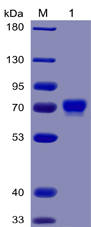 Human MSLN(296-580) Protein, mFc-His Tag