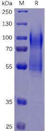 Human CD34 Protein, His Tag