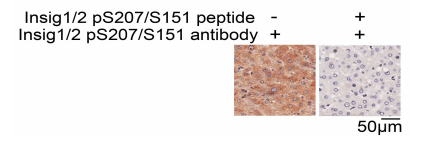 Insig1/2(Phospho-Ser207/151) Antibody