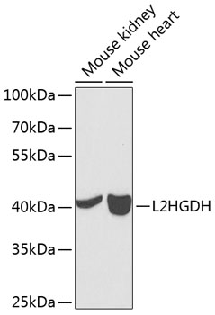 L2HGDH Polyclonal Antibody