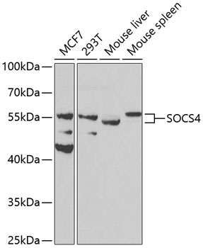 SOCS4 Polyclonal Antibody