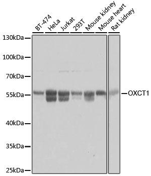 OXCT1 Polyclonal Antibody