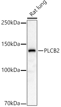 PLCB2 Polyclonal Antibody