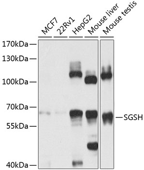 SGSH Polyclonal Antibody