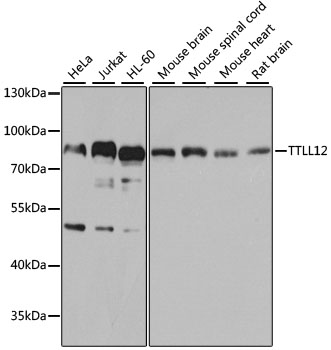 TTLL12 Polyclonal Antibody