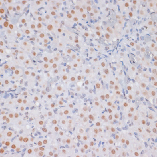 Histone H3K27me3 Polyclonal Antibody