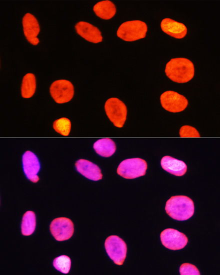 Histone H3R2me2s Polyclonal Antibody