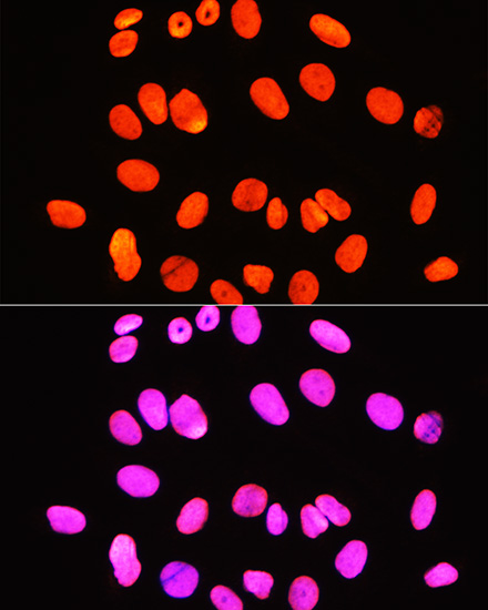 Histone H3R2me2s Polyclonal Antibody