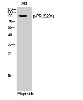 Progesterone Receptor (Phospho-Ser294) Antibody