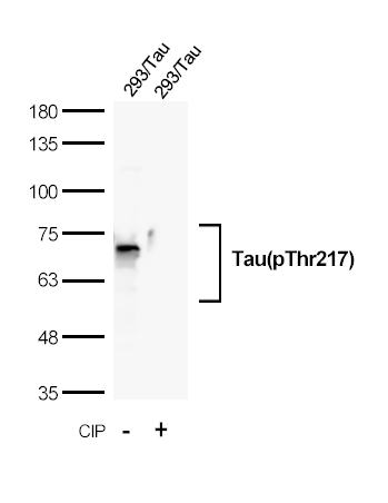 Recombinant Tau(Phospho-Thr217) Rabbit mAb(G122)