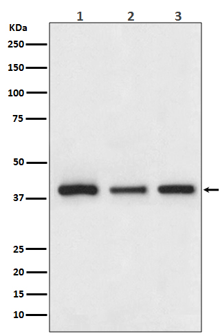 Cathepsin L/V/K/H Rabbit mAb