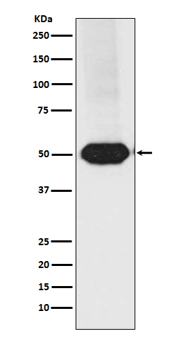 MEF2A+MEF2C Rabbit mAb