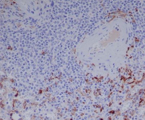 Human IgG Rabbit mAb