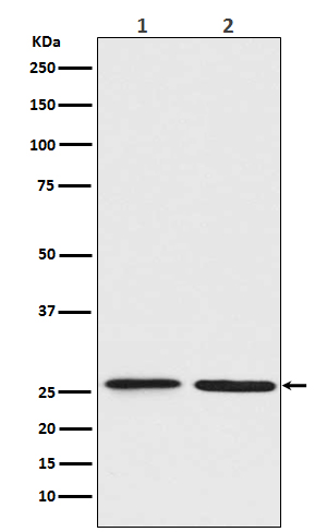 BNIP1 Rabbit mAb