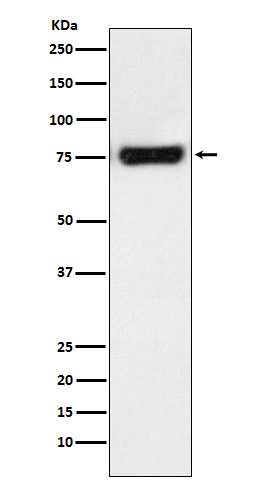 MTA2 Rabbit mAb