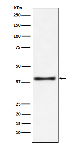 Aspartate Aminotransferase Rabbit mAb 