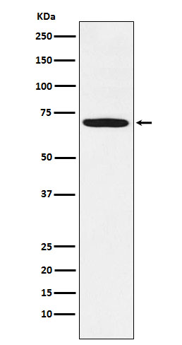 LIMK1 Rabbit mAb