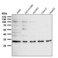 MCU Antibody