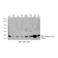 CDK4 (Phospho-Thr172) Antibody