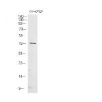 Gz-α (Phospho-Ser16) Antibody