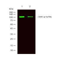 DDR1 (Phospho-Tyr796) Antibody
