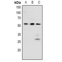 BRK (Phospho-Tyr342) Antibody