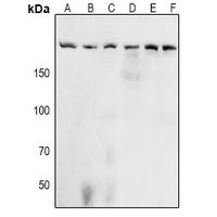 Acinus (Phospho-Ser1180) Antibody