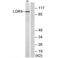 GPR48 Antibody