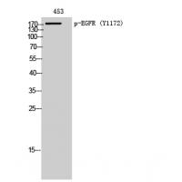EGFR (Phospho-Tyr 1172) Antibody