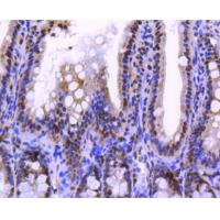 Histone H2A.Z Rabbit mAb