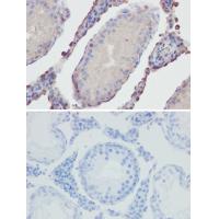 ANGPTL4 Antibody