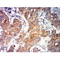 E-Cadherin Monoclonal Antibody