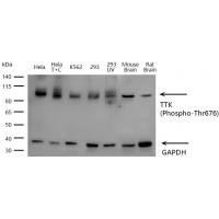 TTK (Phospho-Thr676) Antibody