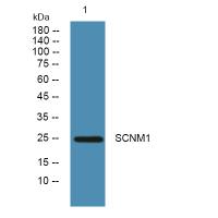 SCNM1 Polyclonal Antibody