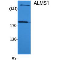 ALMS1 Polyclonal Antibody