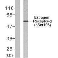 Estrogen Receptor-a(Phospho-Ser106) Antibody