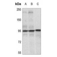 IGF-1R(Phospho-Tyr1165/Tyr1166) Antibody