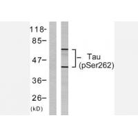 Tau(Phospho-Ser262) Antibody