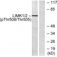 LIMK1(Phospho-Thr508) Antibody