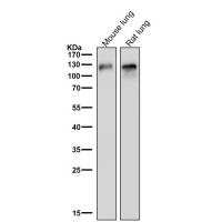 CD146 Rabbit mAb