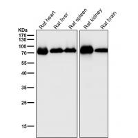 Cytochrome P450 1B1 Rabbit mAb