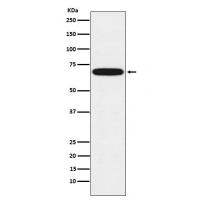 Cytochrome P450 1B1 Rabbit mAb