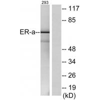Estrogen Receptor-a Antibody