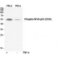 NFkB-p65(Phospho-Ser536) Antibody